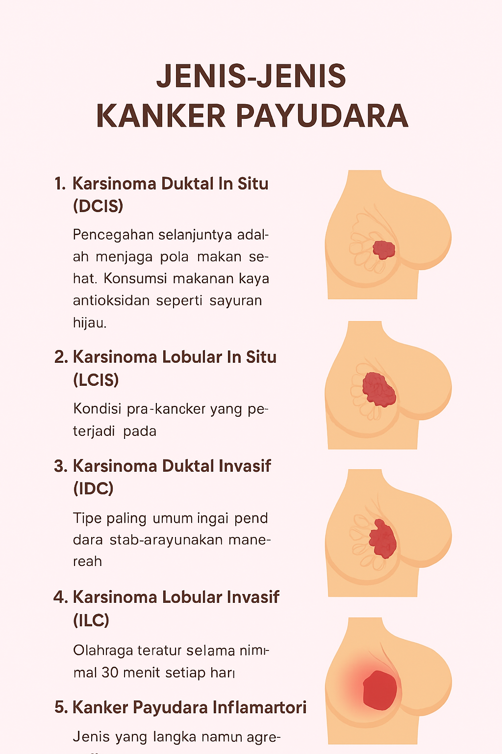 jenis jenis kanker Payudara